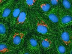 hela-cells-544312_640