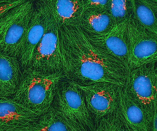 hela-cells-544312_640